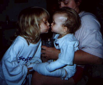 Big sister Mikaila is kissing little sister Miranda, 1 RDEB (mom is holding Miranda)